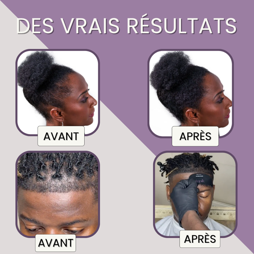 FIBRE CAPILLAIRE COUVRANTE &amp; DENSIFIANTE SANS TRANSFERT l TOPIK HAIR PARIS