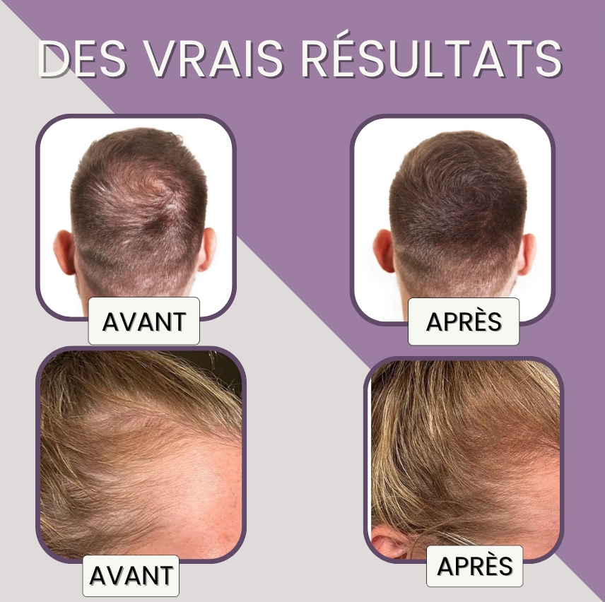 FIBRE CAPILLAIRE COUVRANTE &amp; DENSIFIANTE SANS TRANSFERT l TOPIK HAIR PARIS